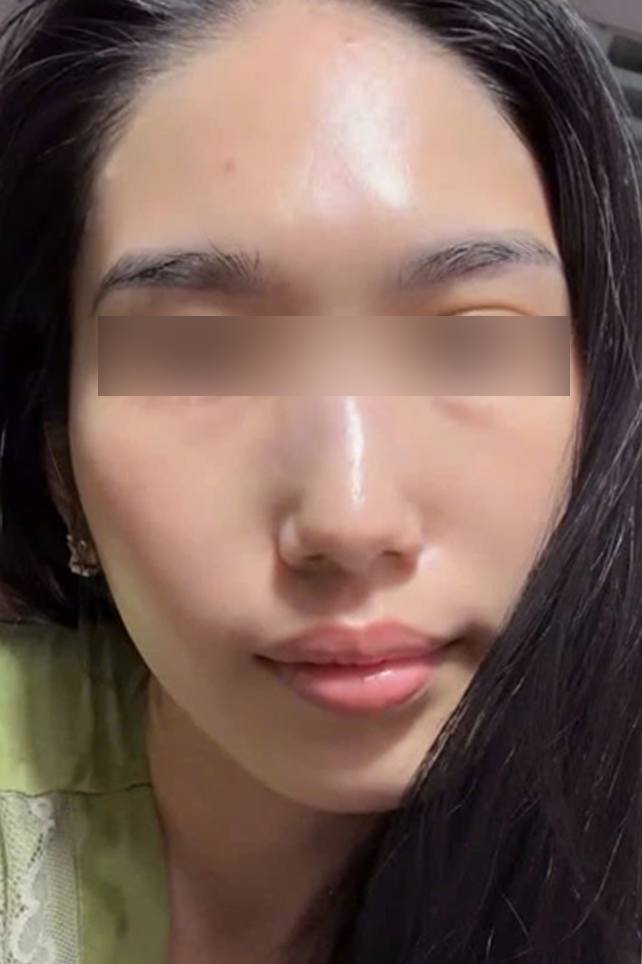 After Image