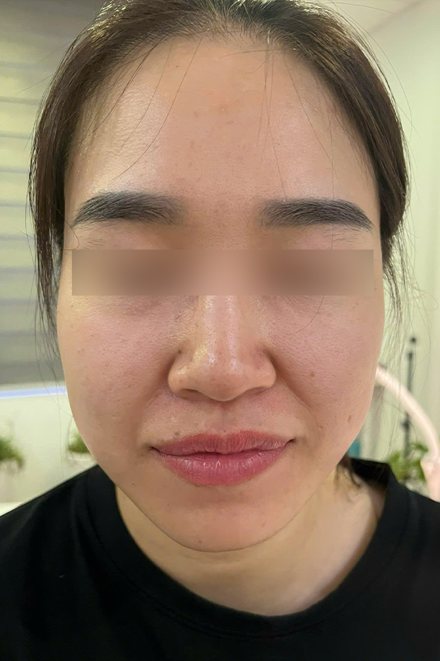 Before Image
